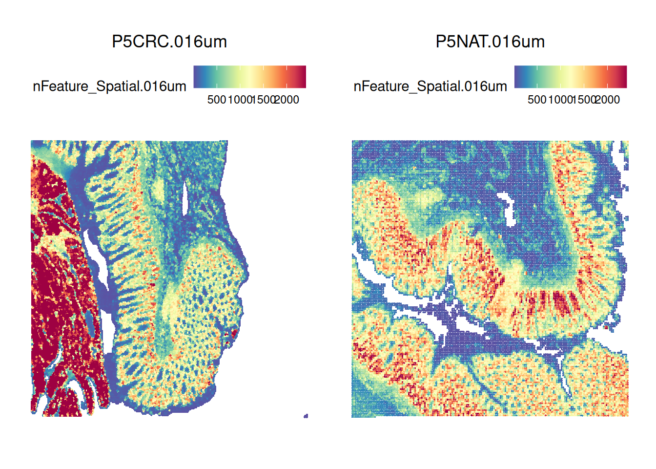Spatial transcriptomics workshop preview